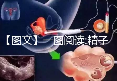 【圖文】一圖閱讀:精子和卵子結合有多難！