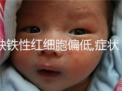 缺鐵性紅細(xì)胞偏低,癥狀多以精神萎靡為多