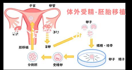 做個試管嬰兒得多少錢