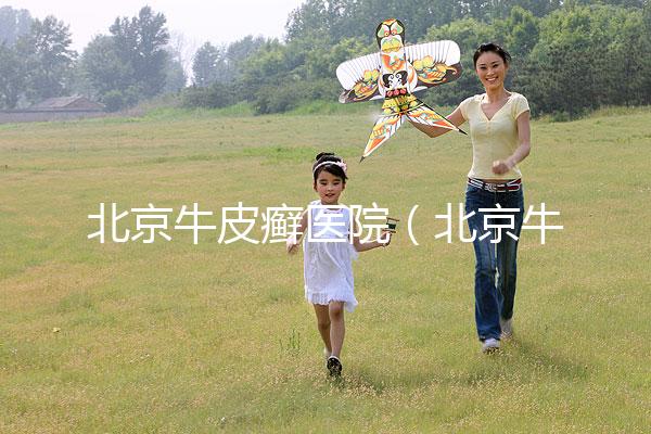 北京牛皮癬醫院(北京牛皮癬醫院排名)