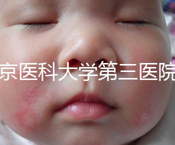 北京醫(yī)科大學(xué)第三醫(yī)院nt檢查費(fèi)用盤(pán)點(diǎn)需要多長(zhǎng)時(shí)間，是否預(yù)約