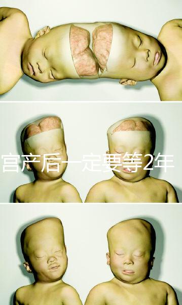 剖宮產后一定要等2年,才能試管嬰兒懷孕嗎?