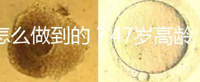 怎么做到的？47歲高齡試管嬰兒唯一男胚一次移植成功！