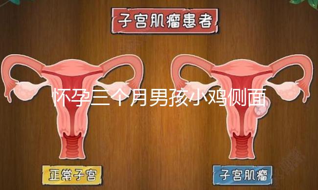 懷孕三個月男孩小雞側面二維b超圖片分享，原來兩腿間有尖