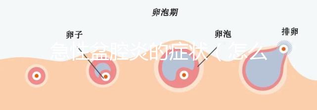 急性盆腔炎的癥狀（怎么判斷是急性盆腔炎）