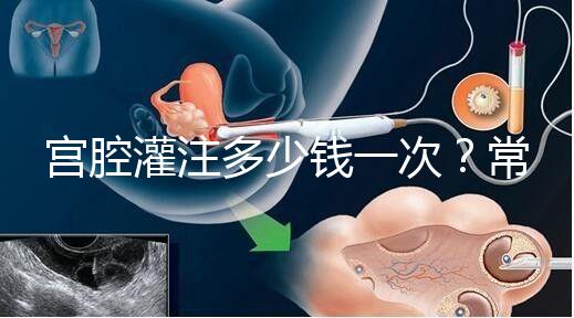 宮腔灌注多少錢一次？常見疑問(wèn)匯總答疑