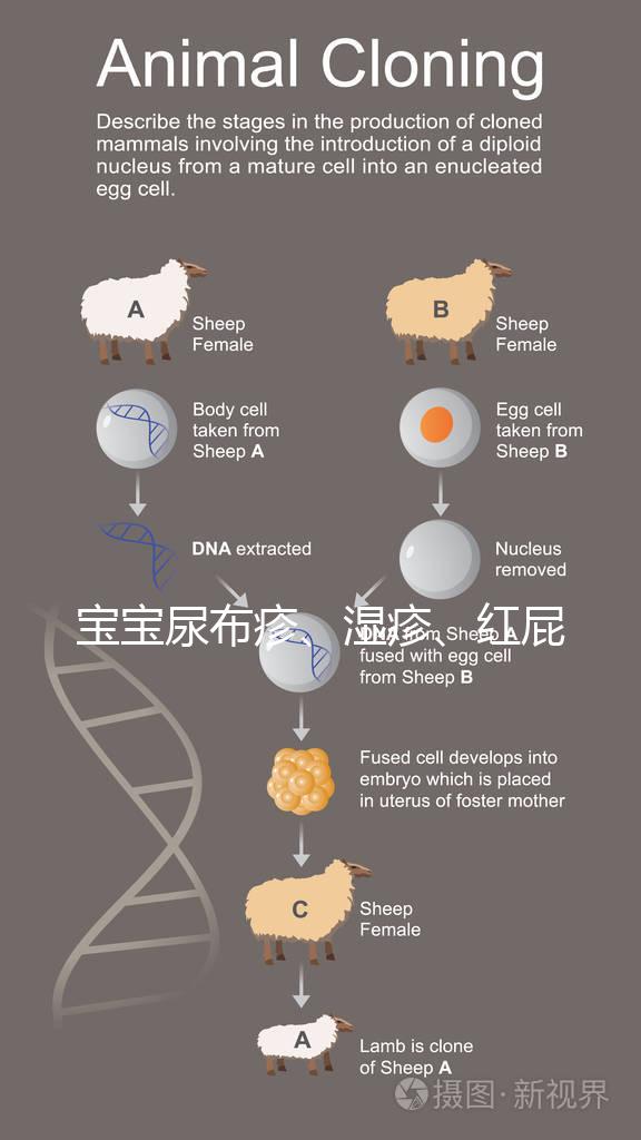 寶寶尿布疹、濕疹、紅屁股傻傻分不清？4點區別輕松診斷