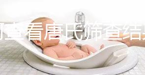 如何查看唐氏篩查結果，珠海醫院價格二百四起