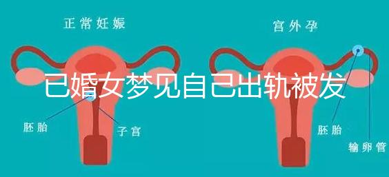 已婚女夢(mèng)見(jiàn)自己出軌被發(fā)現(xiàn)什么意思來(lái)瞧,或和心理有關(guān)系