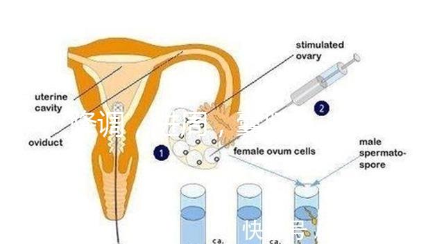 降調(diào)，進(jìn)周，囊胚……這些試管嬰兒助孕術(shù)語(yǔ)你都懂嗎？