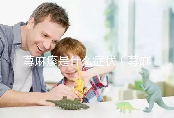 蕁麻疹是什么癥狀（蕁麻疹是什么癥狀和表現(xiàn)）