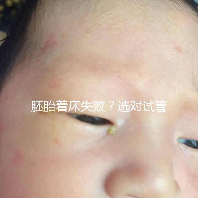 胚胎著床失敗？選對試管嬰兒醫生很重要