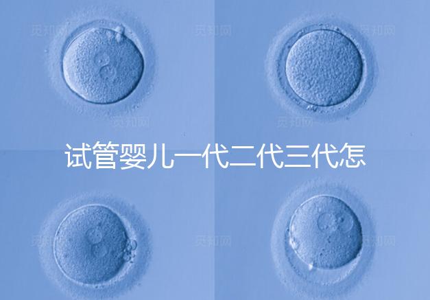試管嬰兒一代二代三代怎么選？