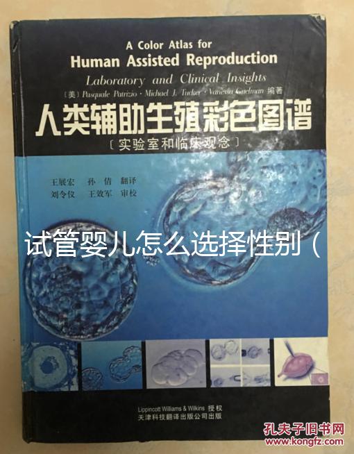 試管嬰兒怎么選擇性別（試管嬰兒怎么選擇性別的）
