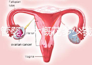 試管嬰兒大概花多少錢(qián)(試管嬰兒大概花多少錢(qián)費(fèi)用)