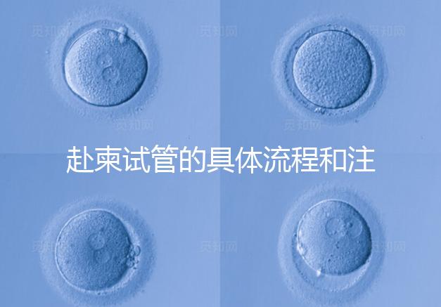 赴柬試管的具體流程和注意事項