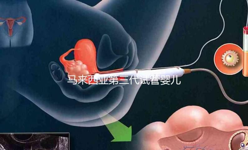 馬來(lái)西亞第三代試管嬰兒限時(shí)優(yōu)惠套餐12萬(wàn)元人民幣