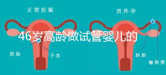 46歲高齡做試管嬰兒的成功幾率有多大？聽聽大家怎么說