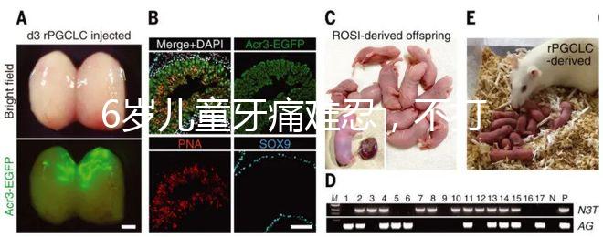 6歲兒童牙痛難忍,不打針吃藥5個(gè)小妙招快速止疼