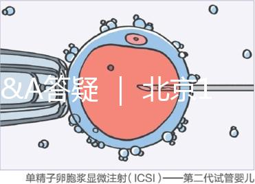 Q&A答疑 | 北京16項輔助生殖技術進醫保,試管可以報銷嗎?
