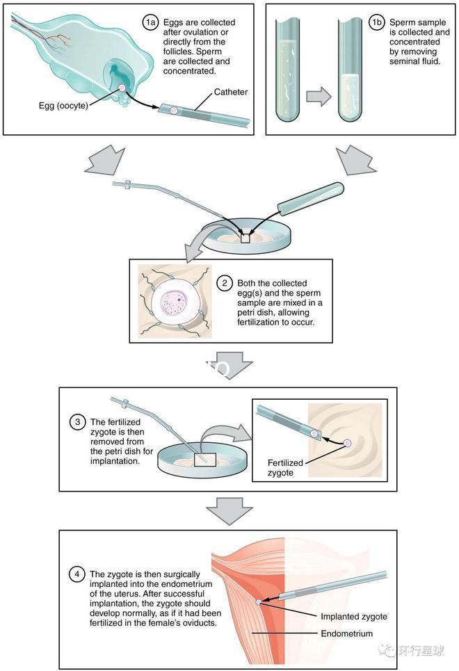 Reprod. Biomed:奇跡、突破、爭議、反思——“試管嬰兒”40年
